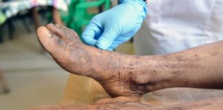 Dépigmentation masculine, une réalité en Guinée